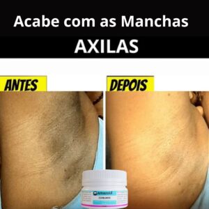 Manchas no Rosto (1)